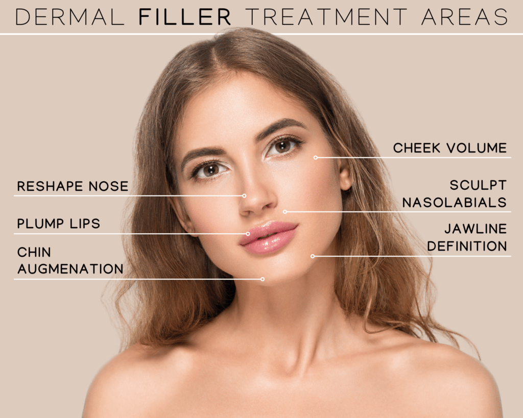 Dermal Fillers Treatment Areas-Understanding When To Use