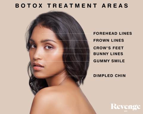 BOTOX TREATMENT AREAS