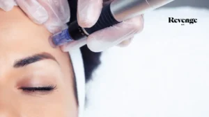 Microneedling in Las Vegas, NV