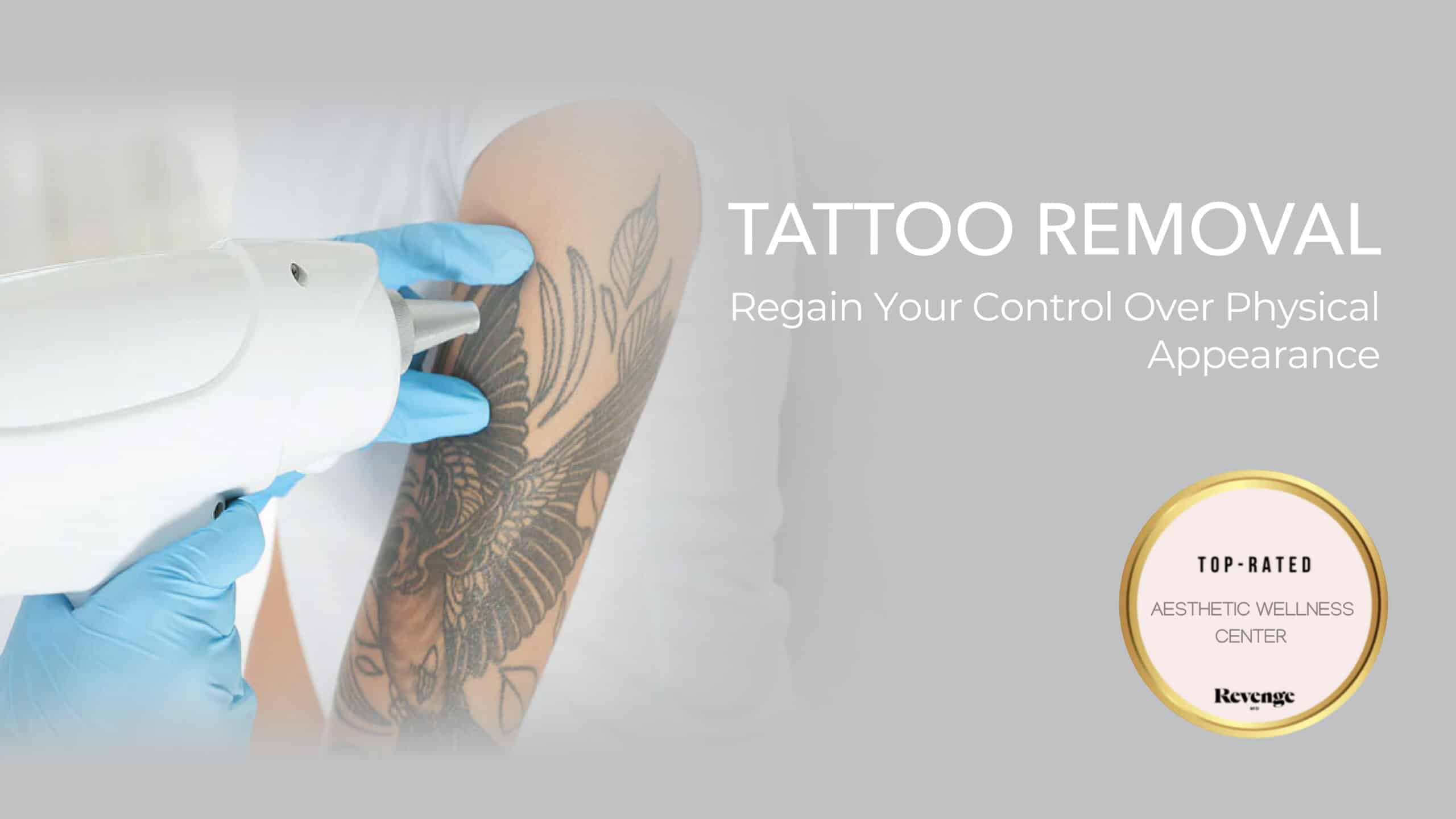 Tattoo Removal in Las Vegas, NV