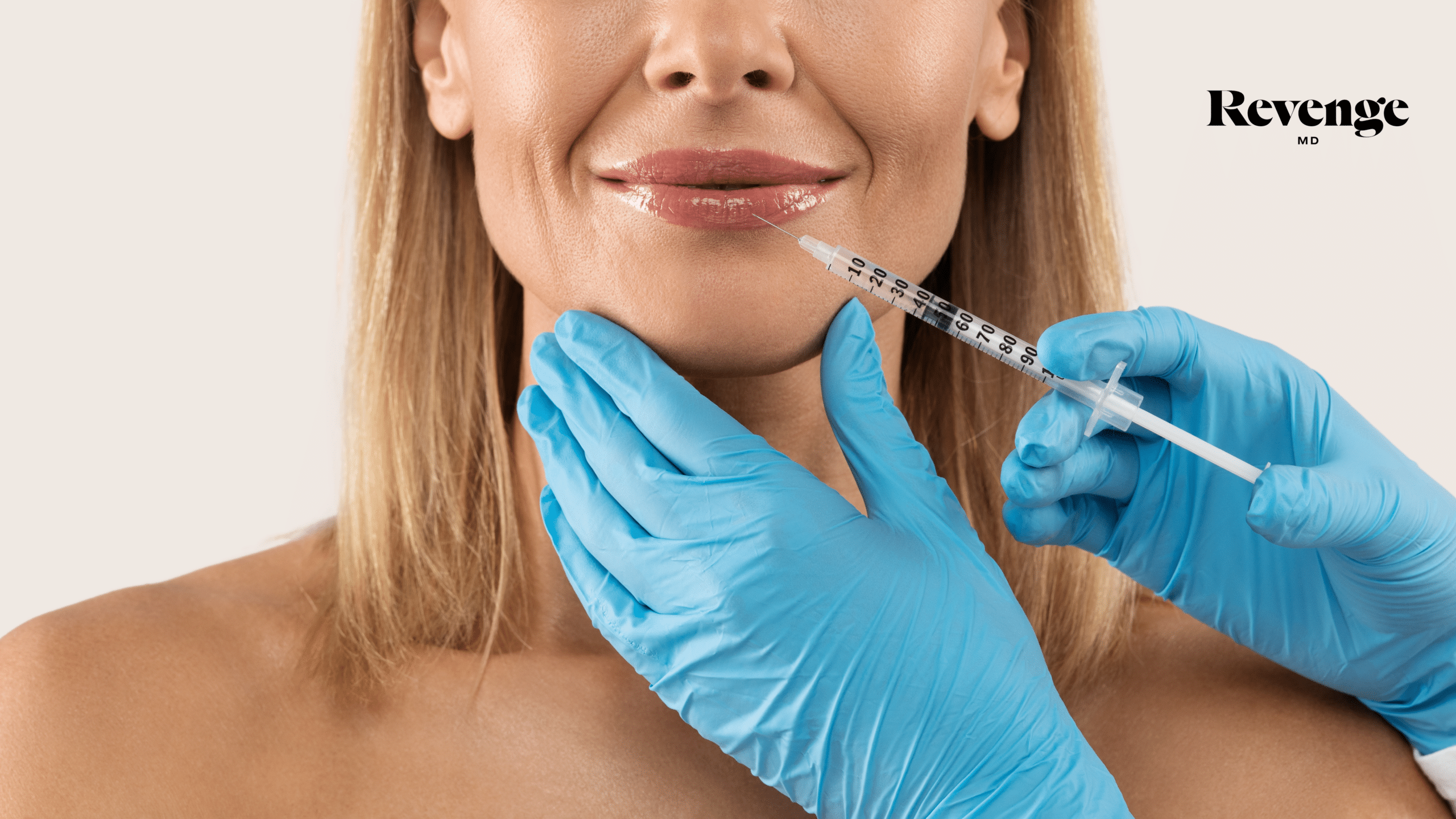 Choosing the Perfect Lip Filler: Expert Tips from Revenge MD