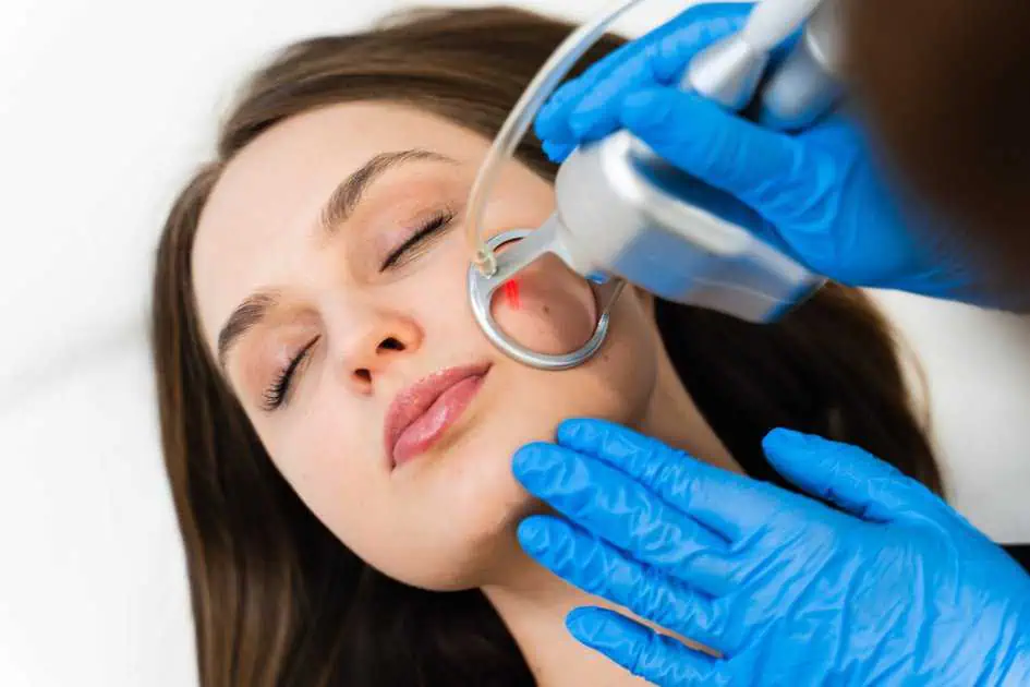 CO2 Laser In HENDERSON, LAS VEGAS by Revenge MD in Nevada