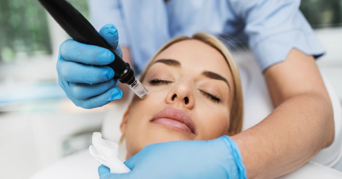 A women Receiving Microneedling in Las Vegas, NV